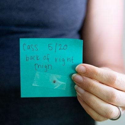 Woman holding a sticky note with a tick taped to it, labeled "Cass, Back of Right Thigh, 5/20"